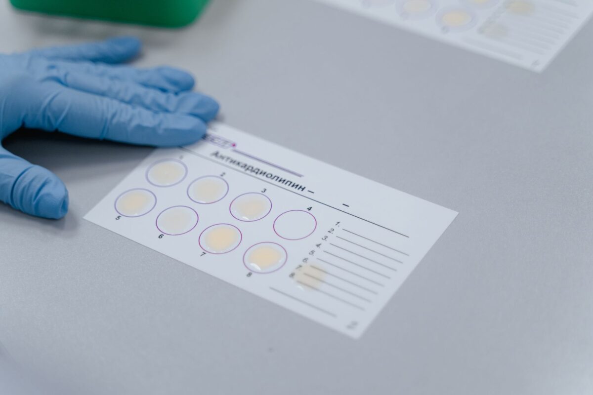 match prf tamponnaise repères fiables suivre